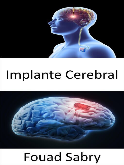 Title details for Implante Cerebral by Fouad Sabry - Available